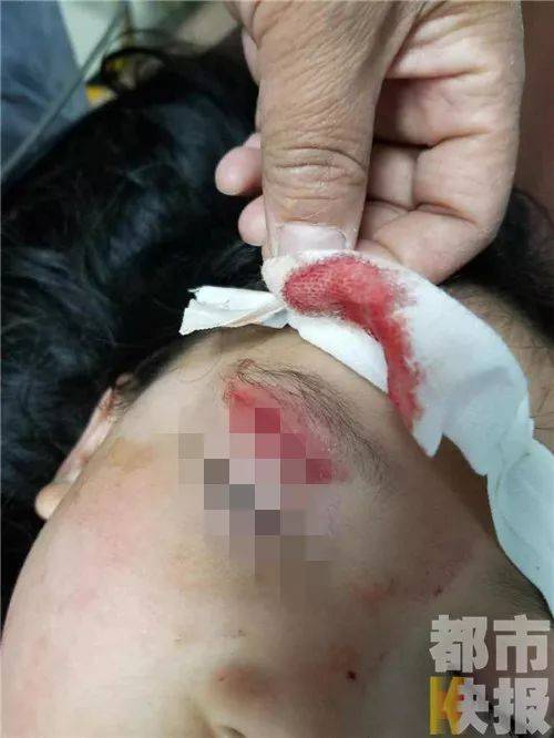 多名孩子在景区水池被瓷砖割伤